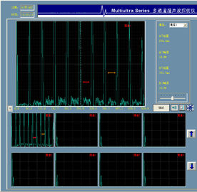 Детекторы ХФД-1000 рванины высокого мульти-канала стабильности ультразвуковые с 2 до 16 каналами